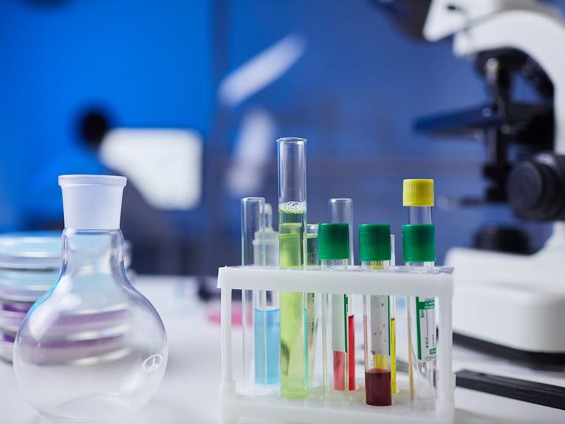 Vasos_vidrio_tubo_prueba_muestras_sangre_mesa_laboratorio_medico