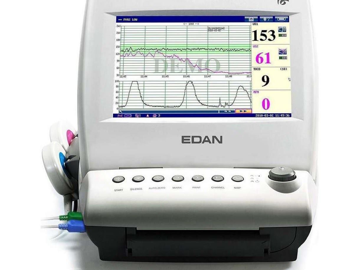 MONITOR FETAL F6 EXPRESS